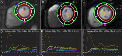 Additive Effects of Obesity on Myocardial Microcirculation and Left Ventricular Deformation in Essential Hypertension: A Contrast-Enhanced Cardiac Magnetic Resonance Imaging Study